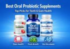 Best Oral Probiotic Supplements – Top Dental Probiotics for 2026